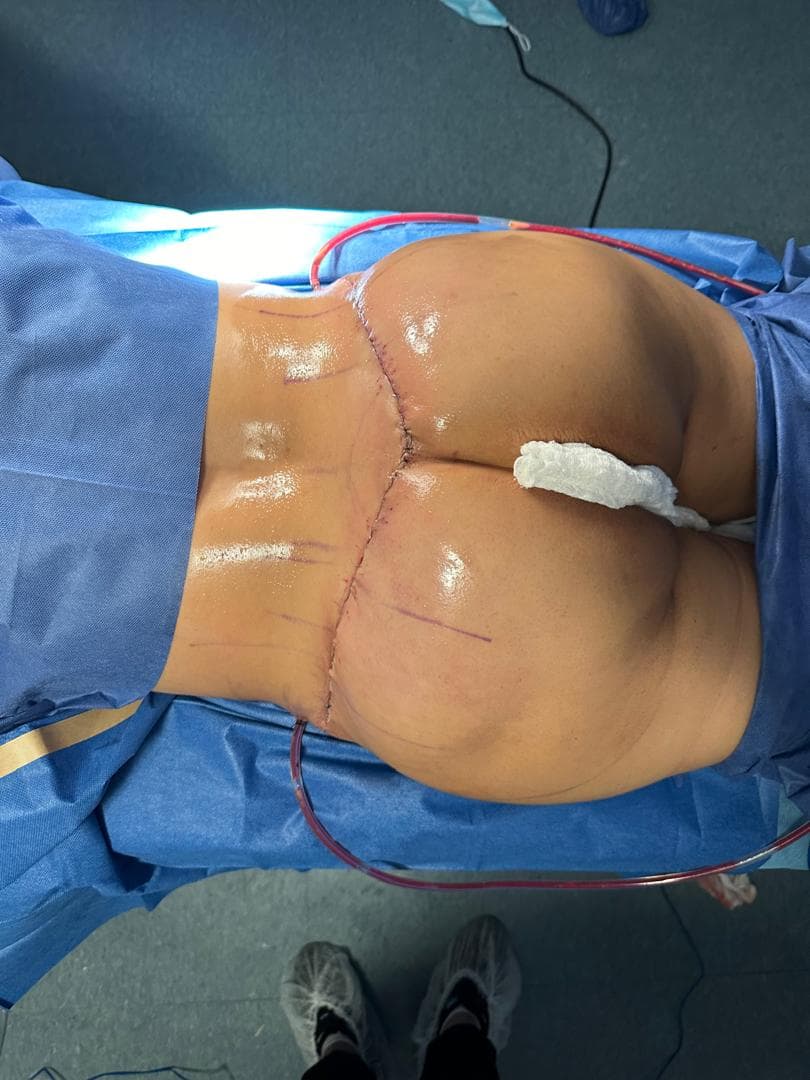 Procedimiento de retiro de biopolimeros