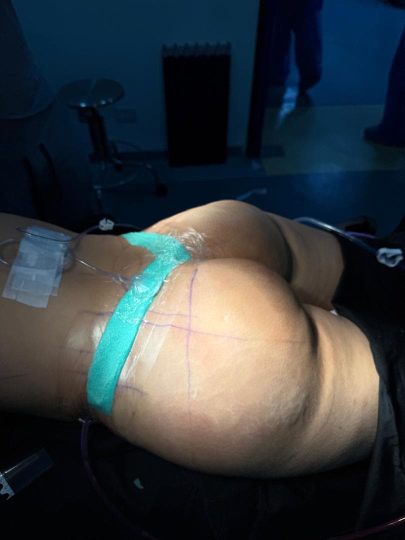 Procedimiento de retiro de biopolimeros