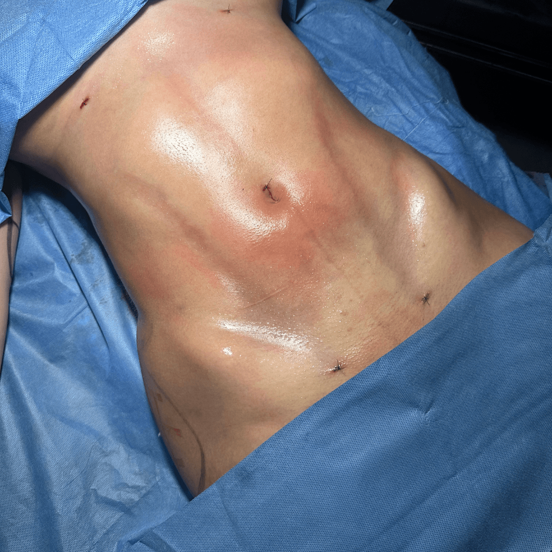 Consulta cirugia plastica