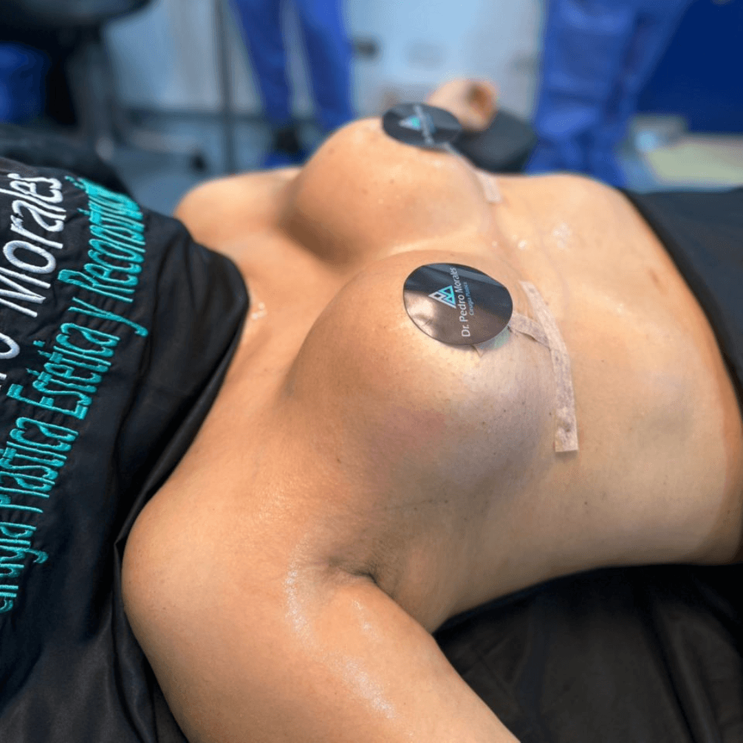 Después cirugia mamaria